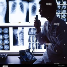 A radiologist examining an X-ray on a lightbox