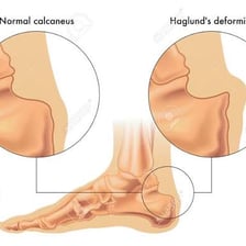Illustration contrasting a typical condition with an abnormal one