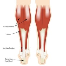 Anatomical illustration highlighting the calf muscle while a person stands on tiptoes