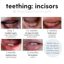 A baby showing newly emerging teeth.