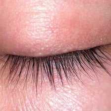 A close-up of a human eye and eyelid
