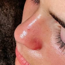A facial treatment focused on cleansing the skin