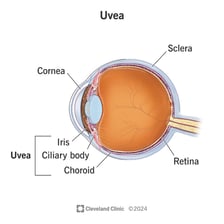 A labeled eye cross-section showing the uvea, iris, choroid, and ciliary body.