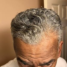 A close view of a person’s hair forming an unmistakable cowlick.