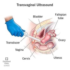 An ultrasound examination focused on the uterus.