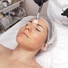 A facial chemical peel being administered in a spa setting