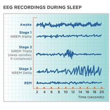 An educational diagram of a sleep cycle highlighting REM sleep
