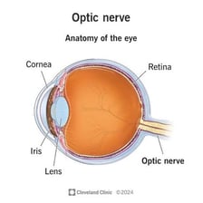 An educational illustration of the eye and optic nerve.