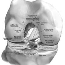 An anatomical diagram locating the anterior cruciate ligament in the knee.
