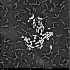 An educational illustration of E. coli bacteria associated with food contamination.