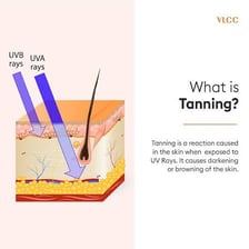Educational illustration showing ultraviolet radiation reaching skin and causing tanning