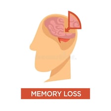 A medical-style illustration representing memory loss.