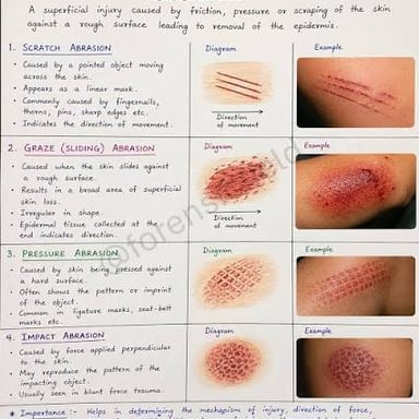 A medical illustration showing a superficial abrasion on skin.