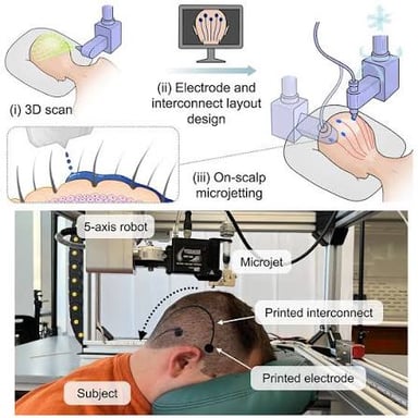 Electrodes on a person’s scalp connected to equipment that records brain-wave activity.
