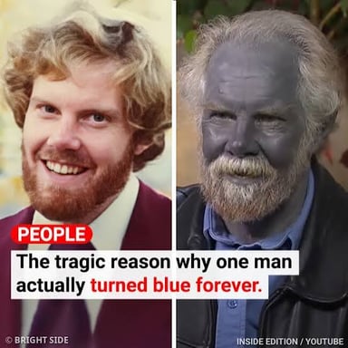 The expression “turns blue” describes someone appearing bluish from intense cold.