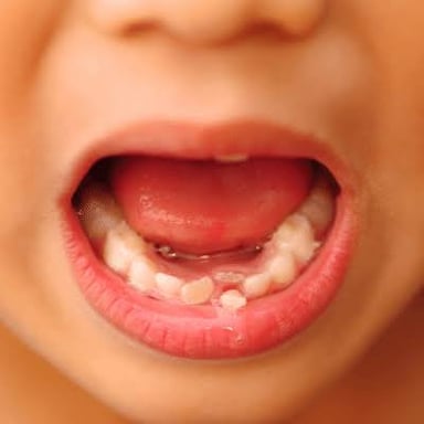 A child showing a loose baby tooth.