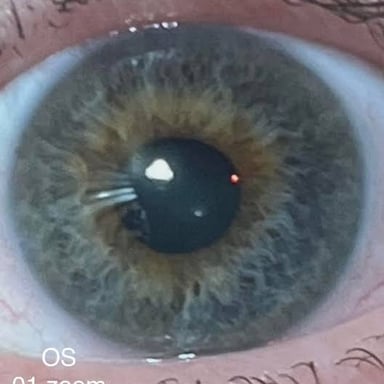A driver’s license showing an eye-color information field