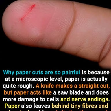 A small paper cut on a fingertip beside a brief handwritten observation.