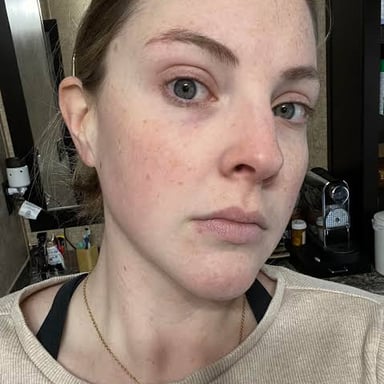 A person with a pale, unwell appearance.