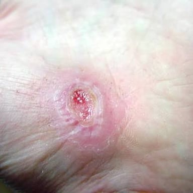 A small cut on skin in the process of healing