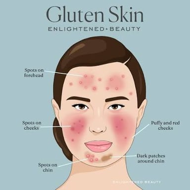 Close view illustrating acne blemishes on skin