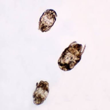 Magnified view of a tiny mite