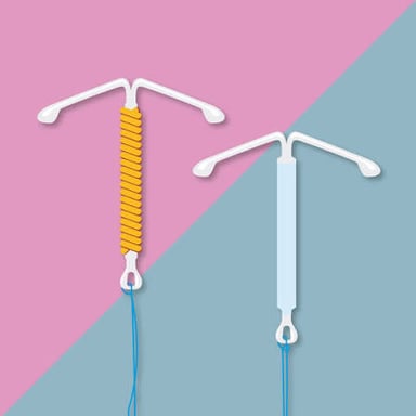 A medical illustration of an intrauterine device, or IUD.