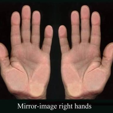 A pair of human hands shown side by side.