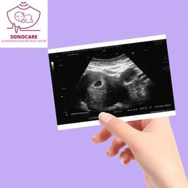 A prenatal ultrasound image shown during a scan.
