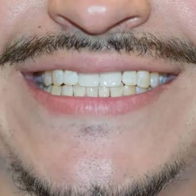 A person smiling with their teeth visible.