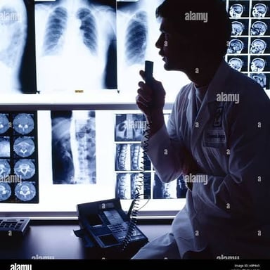A radiologist examining an X-ray on a lightbox