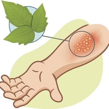 Poison ivy leaves beside an illustration of an itchy rash.