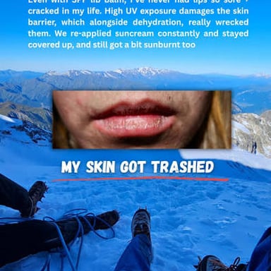 A person in cold weather beginning to show a bluish tint to the lips.
