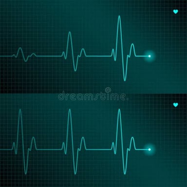 An ECG tracing showing the changing electrical rhythm of a heartbeat.