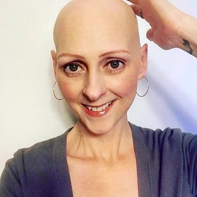 A person with a bald head, illustrating the hair-related meaning of “un-locked.”