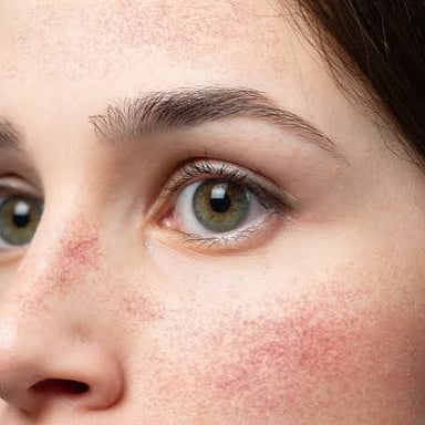 A person with pink, rosy cheeks.